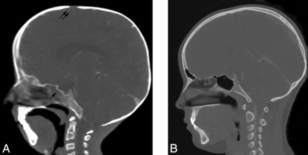 Fig 2.