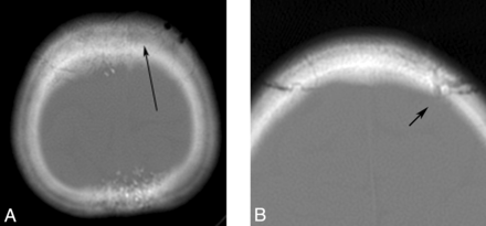 Fig 3.