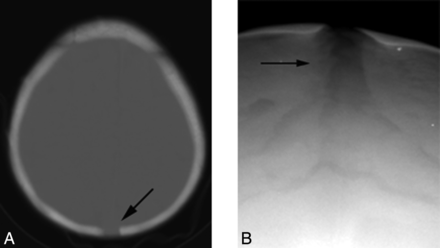 Fig 4.