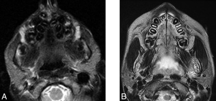 Fig 8.