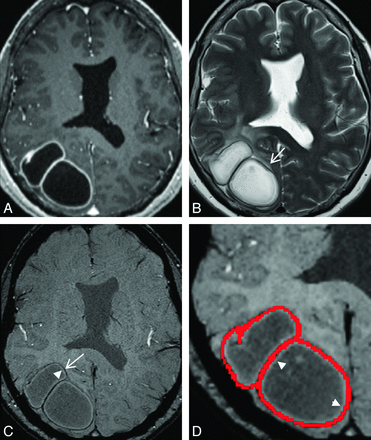 Fig 1.