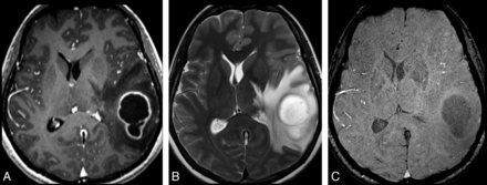 Fig 3.