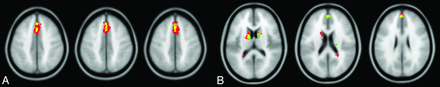 Fig 1.