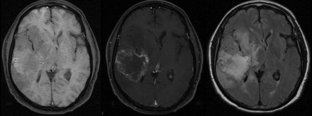 Fig 1.