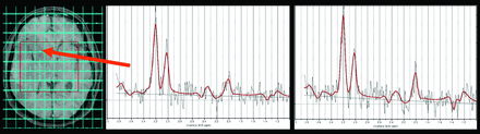 Fig 2.