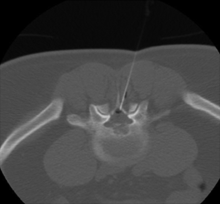Fig 2.