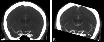 Fig 1.