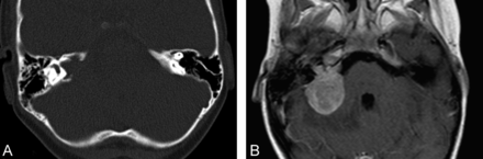 Fig 4.