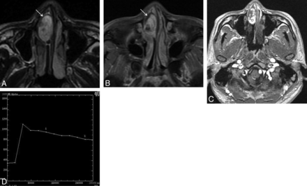 Fig 2.