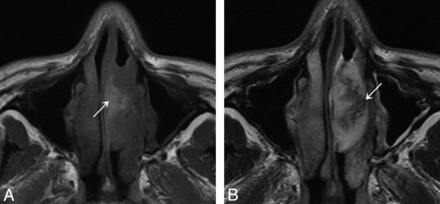 Fig 3.