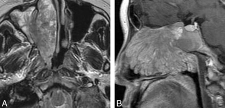 Fig 4.
