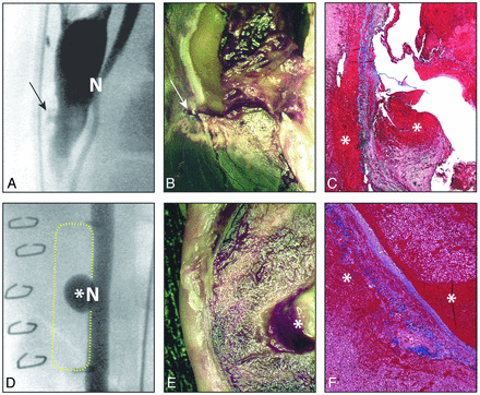 Fig 2.