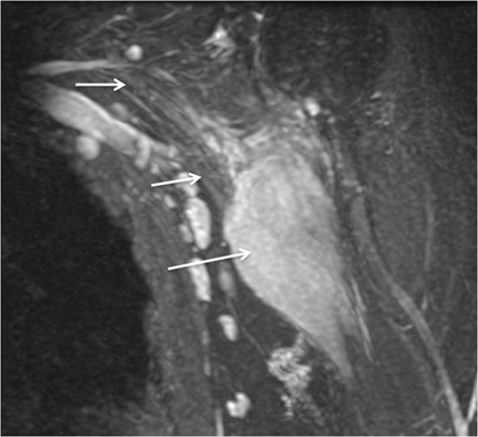 Fig. 12.