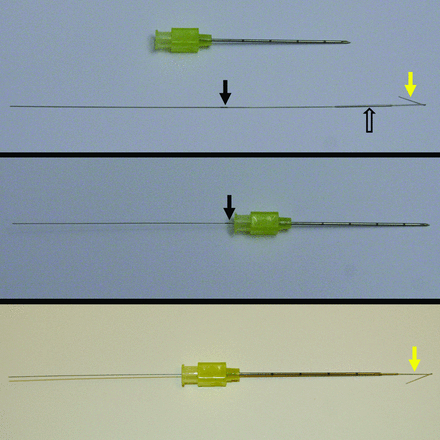 Fig. 2.