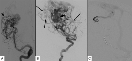 Fig 2.