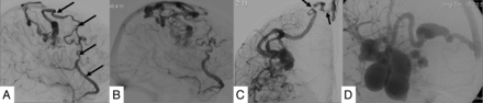 Fig 3.