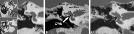 Fig 1.