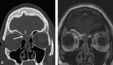 Fig 6.