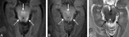 Fig 3.