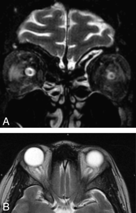 Fig 1.