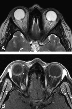 Fig 2.