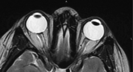 Fig 3.