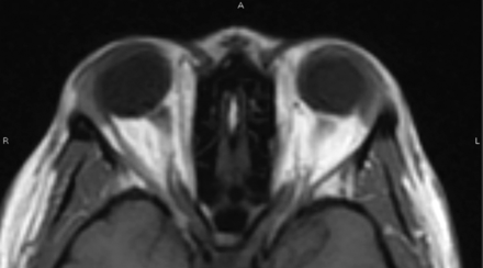 Fig 4.