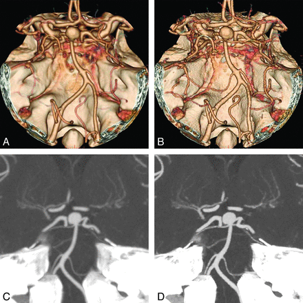 Fig 1.