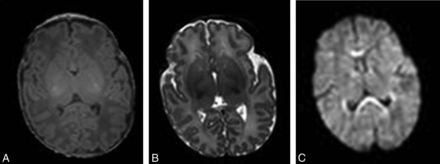 Fig 1.