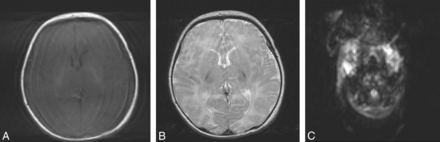 Fig 2.