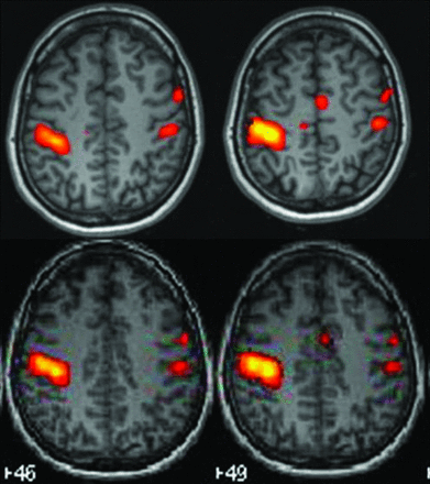 Fig 1.