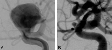 Fig 2.