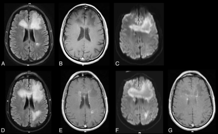 Fig 3.
