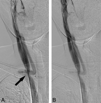 Fig 2.