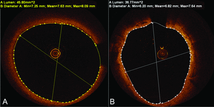 Fig 4.