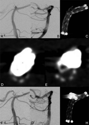 Fig 2.