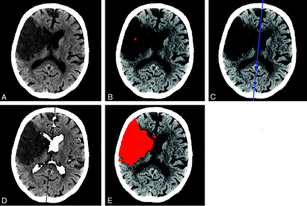 Fig 1.