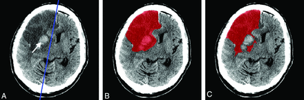 Fig 2.