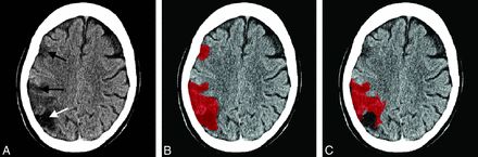 Fig 3.