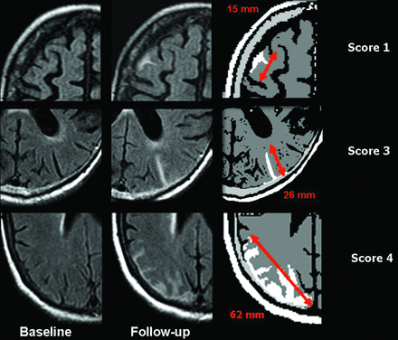 Fig 2.