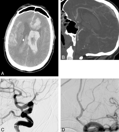 Fig 1.
