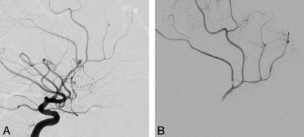Fig 2.