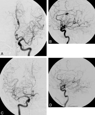 Fig 3.