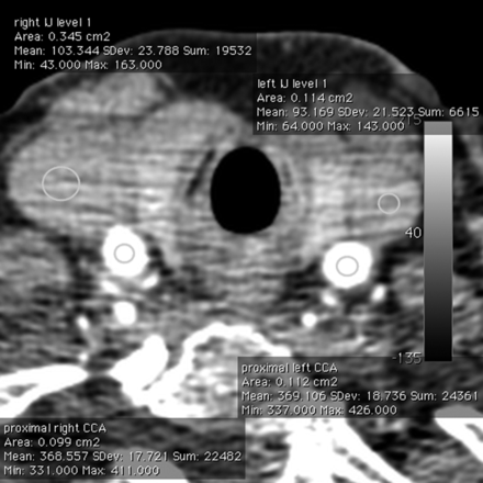 Fig 2.
