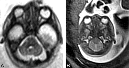 Fig 1.