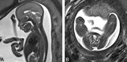 Fig 2.
