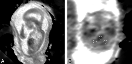 Fig 3.