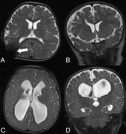 Fig 1.