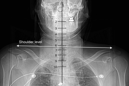 Fig 3.