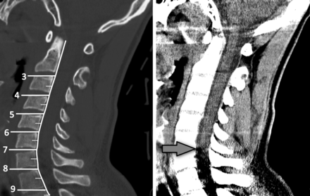 Fig 4.